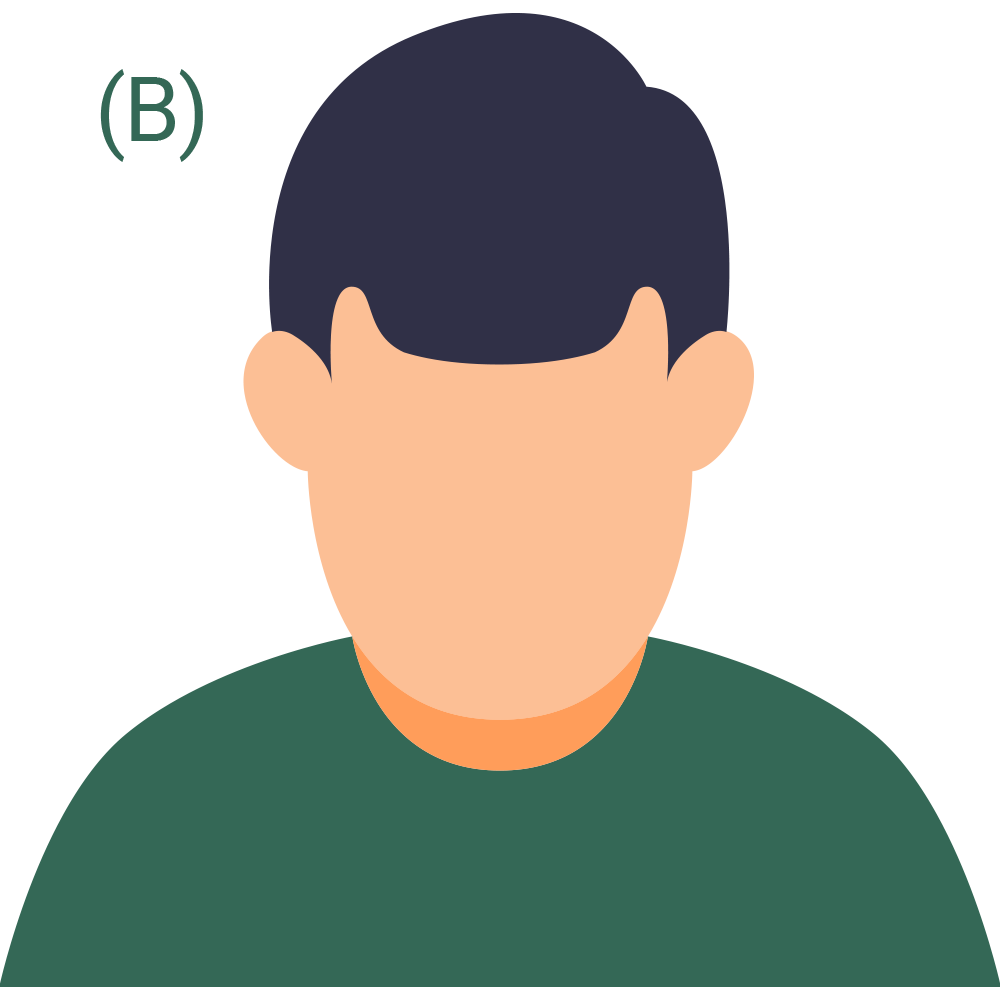 Hair Loss Pattern 2